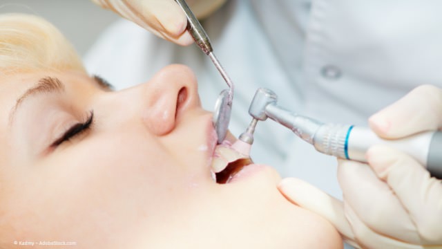 Regelmäßige Professionelle Zahnreinigung schützt vor Karies, Parodontitis und Mundgeruch.